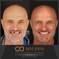 Oasis Dental Studio - Chirn Park image 2
